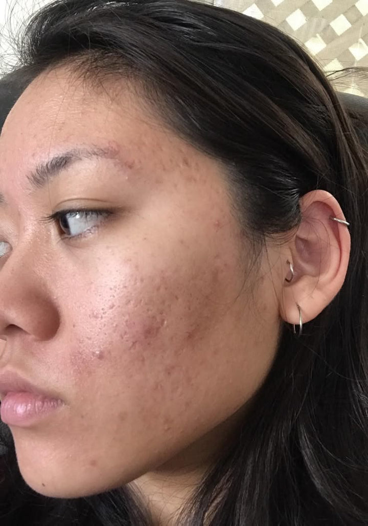 Leni — before photo