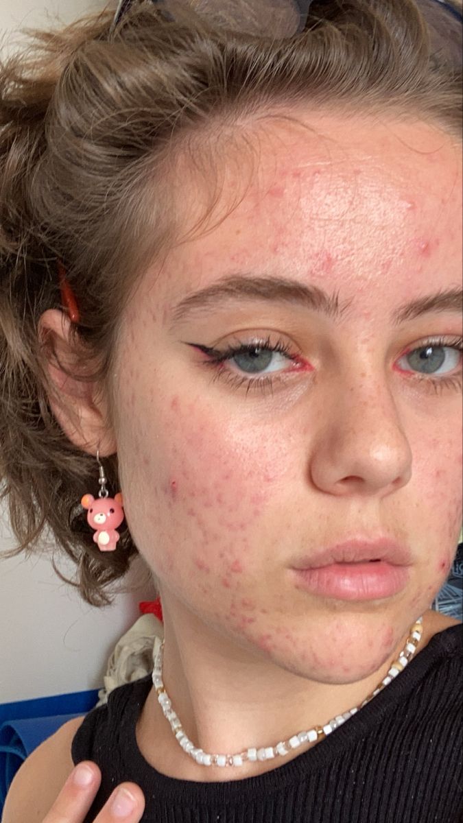 Viviana — before photo